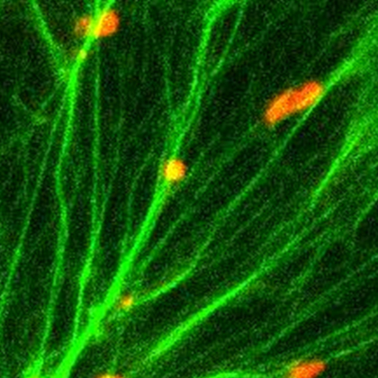 Confocal microscopy image shows peroxisome movement along actin bundles in a tobacco epidermal cell